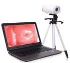 Laptop Video Colposcope