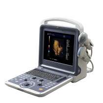 Digital Portable Ultrasound with Led Monitor