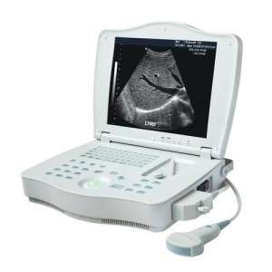 Ultrasound Scanner in India